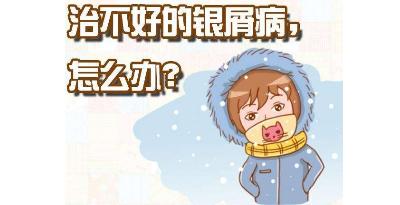 诊断牛皮癣注意哪些细节