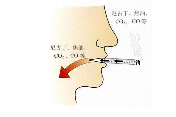 牛皮癣消退期病情加重怎么回事