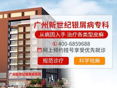 广州新世纪医院银屑病专病门诊介绍