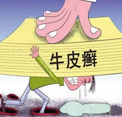 如何制止牛皮癣恶化